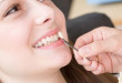 Tổng hợp những kiến thức nhất định phải biết cho người muốn làm răng sứ