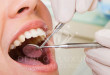 Bật mí : Quy trình niềng răng như thế nào là hợp lý?
