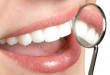  Trám răng thẩm mỹ là như thế nào? thực hiện ra sao