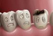 Bị sâu răng: Những nguyên nhân, hệ quả và cách chữa trị tốt nhất