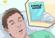 Hướng dẫn chăm sóc sau nhổ răng 8 [Chuyên mục chăm sóc răng]