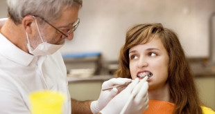 Niềng răng có đau không và ảnh hưởng thế nào đến răng miệng?
