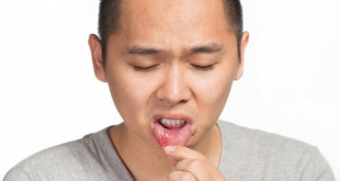 Bệnh lở miệng có lây không?