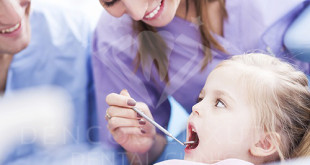 Viêm tủy răng sữa có ảnh hưởng gì không?