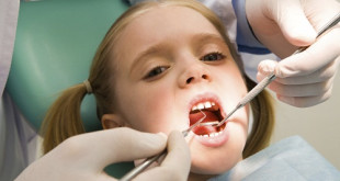 Có nên nhổ răng sâu cho trẻ không?