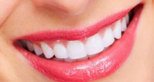 Khi bị hô nhẹ có nên niềng răng không?