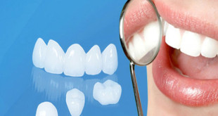 Phục hình răng sứ: Những vấn đề bạn cần biết