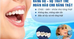 Răng bị thưa phải làm sao để khít lại nhanh chóng