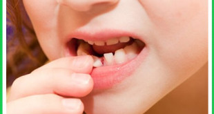 Những điều cần biết về răng hỗn hợp