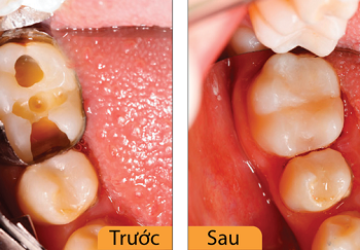 Nha khoa điều trị tủy răng tốt nhất tại Hà Nội?
