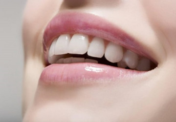 Làm trắng răng với lô hội – Cách được nhiều người lựa chọn