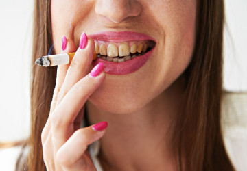 TOP 10 lý do tại sao răng vàng mà nhiều người thường gặp phải
