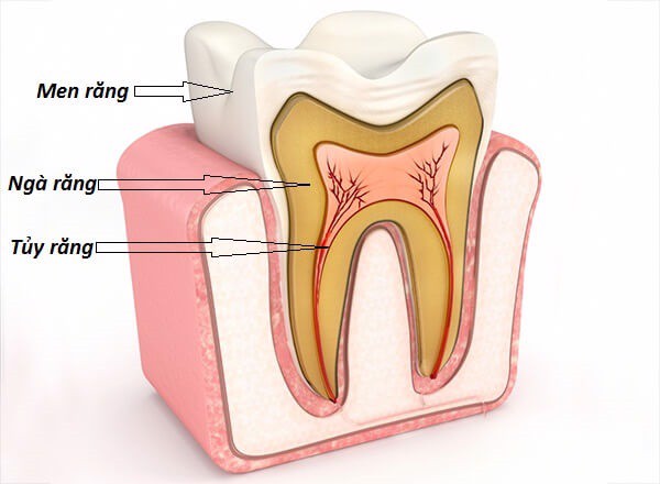 Gãy men răng và ngà răng, tác động tới tủy