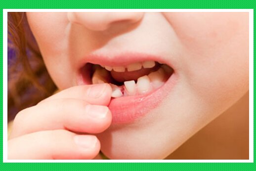 Vai trò của răng sữa