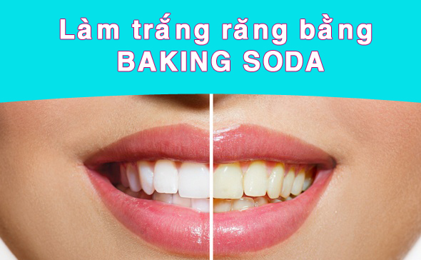 sử dụng bột baking soda làm trắng răng