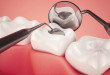 Trám răng là gì và cách thực hiện như thế nào?