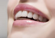 Làm trắng răng với lô hội – Cách được nhiều người lựa chọn