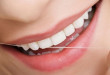 Lấy cao răng xong nên ăn gì? – Kiến thức chăm sóc răng miệng