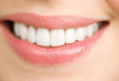Có nên lấy cao răng và làm trắng răng không?