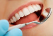 Bọc răng toàn sứ cercon: Giải pháp tăng độ bền độ thẩm mỹ cho hàm răng