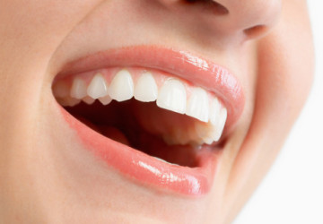 Nguyên nhân răng bị vàng và cách tẩy răng ố vàng hiệu quả