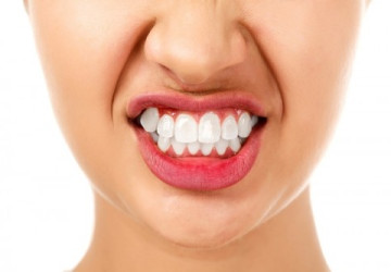 Nguyên nhân gây bệnh nghiến răng – Tác hại khi nghiến răng